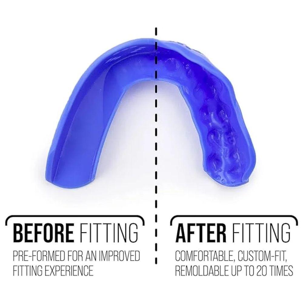 Sisu - 3D Adult Oral Care Mouthguard - Electric Blue - 2 mm